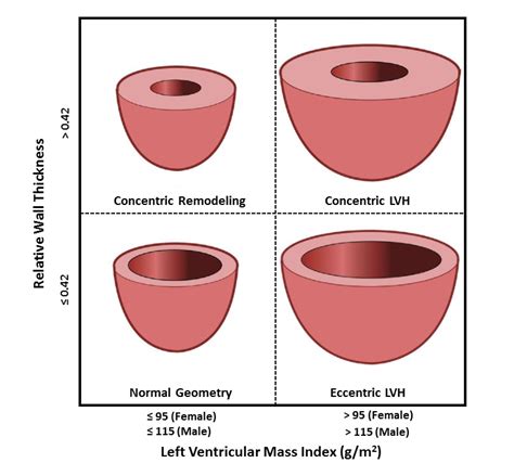 The Value of Left Ventricular Relative Wall Thickness in 